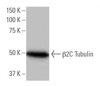 &beta;2C Tubulin Antibody (1A9) - Western Blotting - Image 64798SAM Transcription Activation: SAM system utilizing dCas9-VP64, MS2-P65-HSF1, and sgRNA for precise gene transcription activation. 