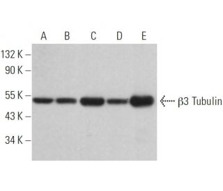 β3 Tubulin Antibody (2G10) - Western Blotting - Image 379358