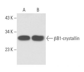 βB1-crystallin Antibody (H-3) - Western Blotting - Image 11040Each CRISPR/Cas9 Knockout (KO) Plasmid product consists of a pool of 3 plasmids designed to ensure identification and cleavage of a specific gene for maximum knockout efficiency. Each plasmid encodes a unique 20 nt sequence derived from the GeCKO (v2) library.