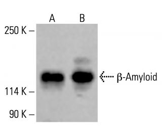 β-Amyloid Antibody (D-11) - Western Blotting - Image 414602