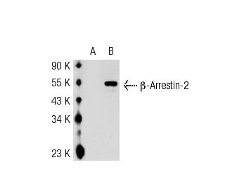 β-Arrestin-2 Antibody (H-9) - Western Blotting - Image 55162