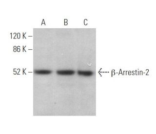 &beta;-Arrestin-2 Antibody (D-5) - Western Blotting - Image 373048 