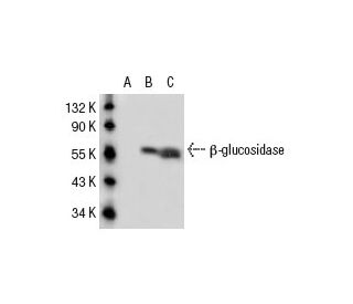 β-glucosidase Antibody (A-16) - Western Blotting - Image 52449