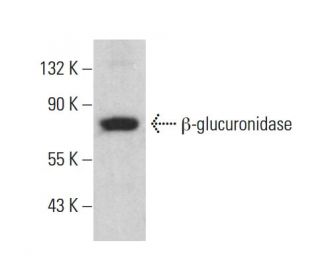 β-glucuronidase Antibody (E-11) - Western Blotting - Image 377010