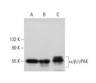 α/β/γPAK Antibody (D-8) - Western Blotting - Image 381137Each CRISPR/Cas9 Knockout (KO) Plasmid product consists of a pool of 3 plasmids designed to ensure identification and cleavage of a specific gene for maximum knockout efficiency. Each plasmid encodes a unique 20 nt sequence derived from the GeCKO (v2) library.