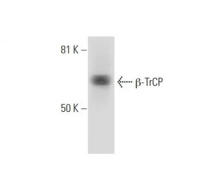 β-TrCP Antibody (C-6) - Western Blotting - Image 289006