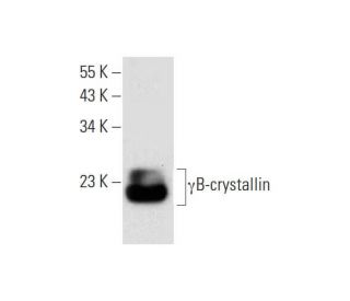 γB-crystallin Antibody (D-5) - Western Blotting - Image 299026
