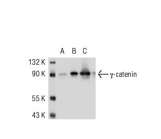 &gamma;-catenin Antibody (11E4) - Western Blotting - Image 52519Each CRISPR/Cas9 Knockout (KO) Plasmid product consists of a pool of 3 plasmids designed to ensure identification and cleavage of a specific gene for maximum knockout efficiency. Each plasmid encodes a unique 20 nt sequence derived from the GeCKO (v2) library. 