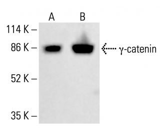 γ-catenin Antibody (15F11) - Western Blotting - Image 413032