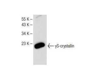 &gamma;S-crystallin Antibody (A-3) - Western Blotting - Image 149625Each CRISPR/Cas9 Knockout (KO) Plasmid product consists of a pool of 3 plasmids designed to ensure identification and cleavage of a specific gene for maximum knockout efficiency. Each plasmid encodes a unique 20 nt sequence derived from the GeCKO (v2) library. 