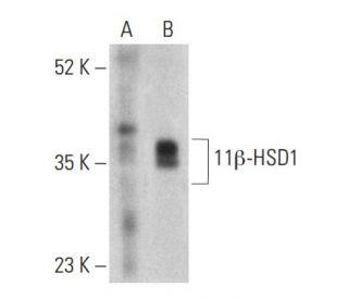 11&beta;-HSD1 Antibody (D-5) - Western Blotting - Image 399409 
