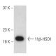 11β-HSD1 Antibody (D-5) - Western Blotting - Image 399408 
