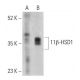 11β-HSD1 Antibody (D-5) - Western Blotting - Image 399409 