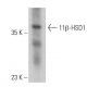 11β-HSD1 Antibody (D-5) - Western Blotting - Image 399410