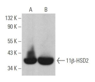 11&beta;-HSD2 Antibody (C-9) - Western Blotting - Image 362885 
