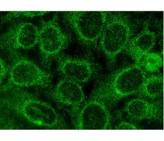 immunofluorescence image from recommended 12-LO (C-5) monoclonal antibody replacement. Image 145099