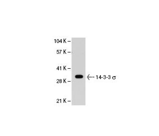 14-3-3 &sigma; Antibody (5D7) - Western Blotting - Image 21562 