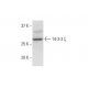 western blotting image from recommended 14-3-3 ζ (1B3) monoclonal antibody replacement. Image 352157