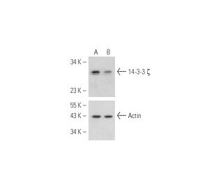 14-3-3 &zeta; siRNA (h): sc-29583. Western blot analysis of 14-3-3 &zeta; expression in non-transfected control (A) and 14 