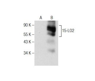 15-LO2 Antibody (D-6) - Western Blotting - Image 160881 