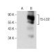 15-LO2 Antibody (D-6) - Western Blotting - Image 160881 