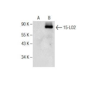 15-LO2 Antibody (F-10) - Western Blotting - Image 159473