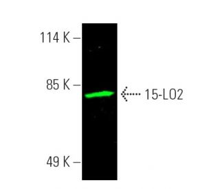 15-LO2 Antibody (D-9) - Western Blotting - Image 391281Each CRISPR/Cas9 Knockout (KO) Plasmid product consists of a pool of 3 plasmids designed to ensure identification and cleavage of a specific gene for maximum knockout efficiency. Each plasmid encodes a unique 20 nt sequence derived from the GeCKO (v2) library.