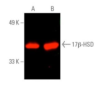 17β-HSD Antibody (D-8) - Western Blotting - Image 389950