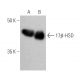 17β-HSD Antibody (A-5) - Western Blotting - Image 370726 