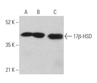 17&beta;-HSD Antibody (D-8) - Western Blotting - Image 360325 