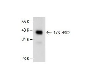 17&beta;-HSD2 Antibody (H-12) - Western Blotting - Image 147779 