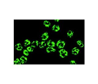 2,2,7-trimethylguanosine Antibody (K121) - Immunofluorescence - Image 10189 