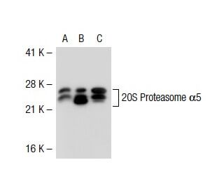 20S Proteasome &alpha;1/&alpha;2/&alpha;3/&alpha;5/&alpha;6/&alpha;7 Antibody (MCP231) - Western Blotting - Image 38891