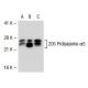 20S Proteasome α1/α2/α3/α5/α6/α7 Antibody (MCP231) - Western Blotting - Image 38891
