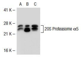 20s-proteasome-alpha1-alpha2-
