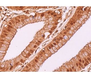 20S Proteasome &alpha;3 Antibody (A-9) - Immunohistochemistry - Image 377172 