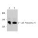 20S Proteasome β7 Antibody (A-10) - Western Blotting - Image 374001 