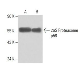 26S Proteasome p58 Antibody (U6/272) - Western Blotting - Image 15667