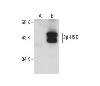 3&beta;-HSD Antibody (37-2) - Western Blotting - Image 127040 