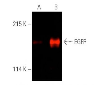 Immunoprecipitated with EGFR (A-10) AC