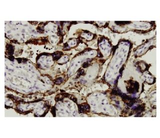 3&beta;-HSD Antibody (37-2) - Immunohistochemistry - Image 36039 