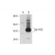 3β-HSD Antibody (37-2) - Western Blotting - Image 127042
