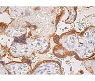 immunohistochemistry image from recommended 3&beta;-HSD (A-1) monoclonal antibody replacement. Image 382973