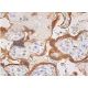 immunohistochemistry image from recommended 3β-HSD (A-1) monoclonal antibody replacement. Image 382973