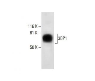 3BP1 Antibody (D-9): sc-376192