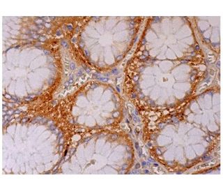 3BP2 Antibody (C-11) - Immunohistochemistry - Image 287097 