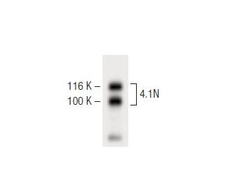 4.1N Antibody (4) - Western Blotting - Image 60223 