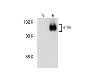 4.1N Antibody (B-2) - Western Blotting - Image 150168 