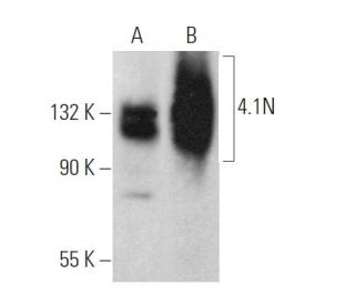 4.1N Antibody (B-2) - Western Blotting - Image 368464 