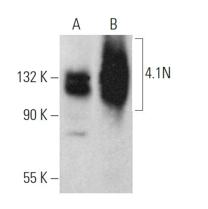 Anti-4.1N Antibody (B-2) | SCBT - Santa Cruz Biotechnology